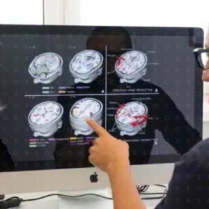 Strumenti di valutazione per la diagnosi differenziale nelle demenze